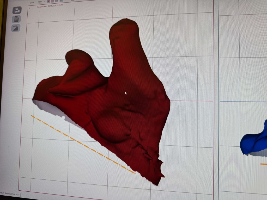 3D Scan fertig Ohrabdruck
